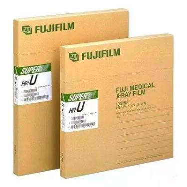 Imagem de Filme Para Raios-X - 24x30cm - Fujifilm