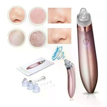 Imagem de Máquina Sucção A Vácuo Remove Cravos Aparelho Acne Cleaning